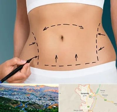 عمل ابدومینوپلاستی در سنندج