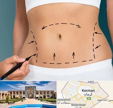 عمل ابدومینوپلاستی در کرمان