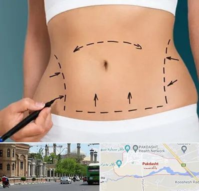 عمل ابدومینوپلاستی در پاکدشت