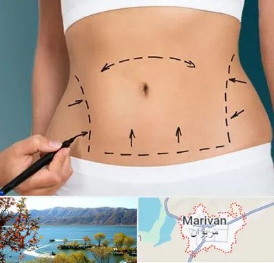 عمل ابدومینوپلاستی در مریوان