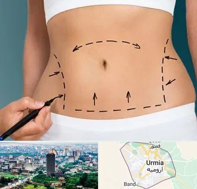 عمل ابدومینوپلاستی در ارومیه