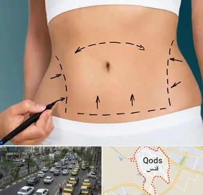 عمل ابدومینوپلاستی در شهر قدس