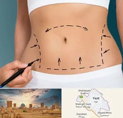عمل ابدومینوپلاستی در یزد