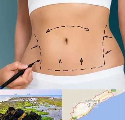 عمل ابدومینوپلاستی در بندرلنگه