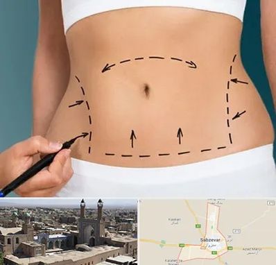 عمل ابدومینوپلاستی در سبزوار