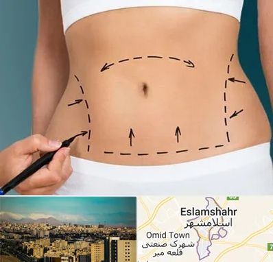 عمل ابدومینوپلاستی در اسلامشهر