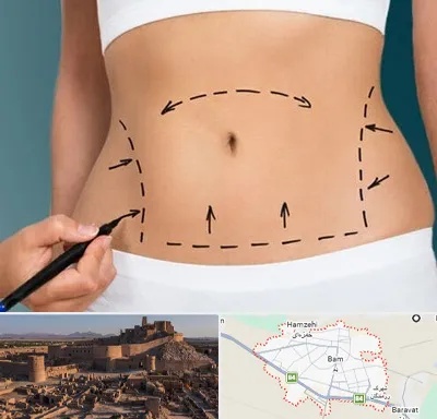 عمل ابدومینوپلاستی در بم