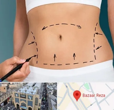 عمل ابدومینوپلاستی در بازار رضا مشهد