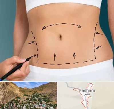 عمل ابدومینوپلاستی در فشم