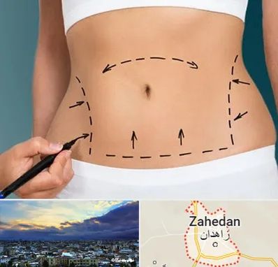 عمل ابدومینوپلاستی در زاهدان