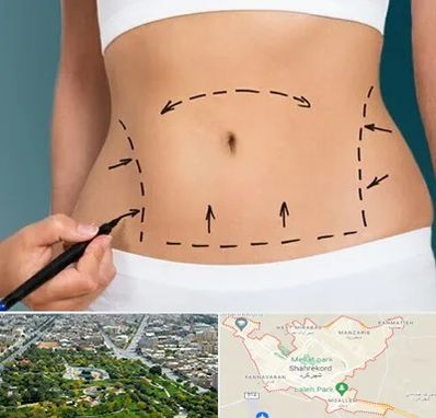 عمل ابدومینوپلاستی در شهرکرد