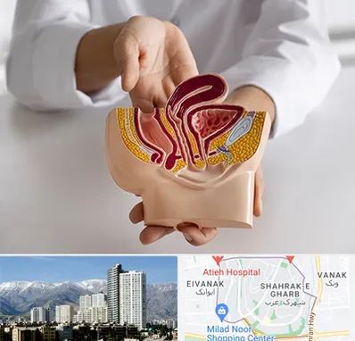 دکتر دستگاه تناسلی مردان در شهرک غرب