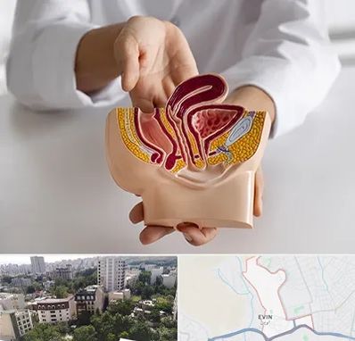 دکتر دستگاه تناسلی مردان در اوین