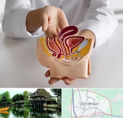 دکتر دستگاه تناسلی مردان در صومعه سرا