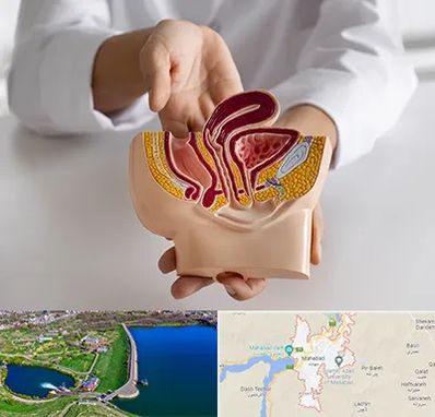 دکتر دستگاه تناسلی مردان در مهاباد