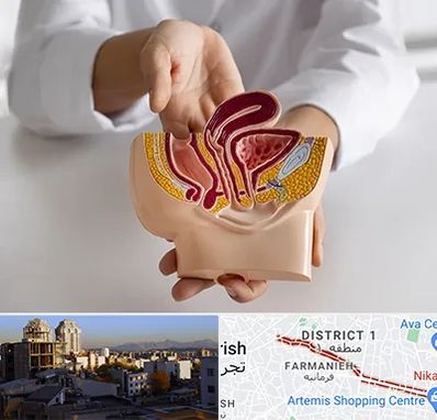 دکتر دستگاه تناسلی مردان در فرمانیه 