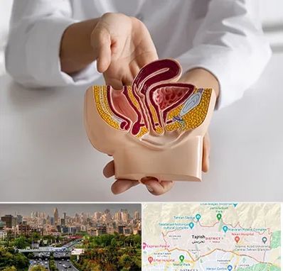 دکتر دستگاه تناسلی مردان در منطقه 1 تهران 