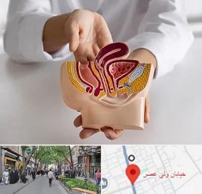 دکتر دستگاه تناسلی مردان در ولیعصر شهریار
