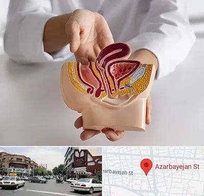 دکتر دستگاه تناسلی مردان در خیابان آذربایجان