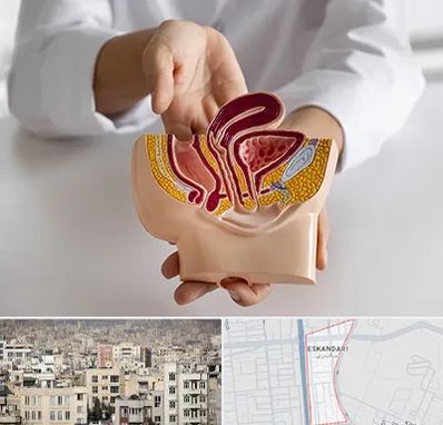 دکتر دستگاه تناسلی مردان در اسکندری