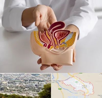 دکتر دستگاه تناسلی مردان در یاسوج