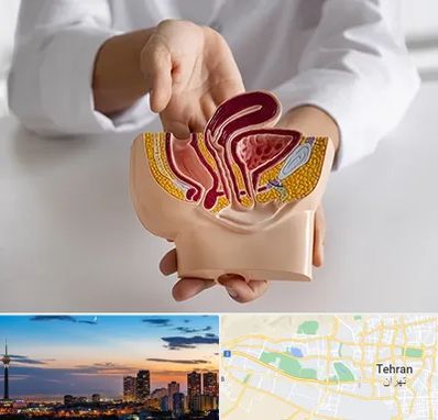دکتر دستگاه تناسلی مردان در غرب تهران 