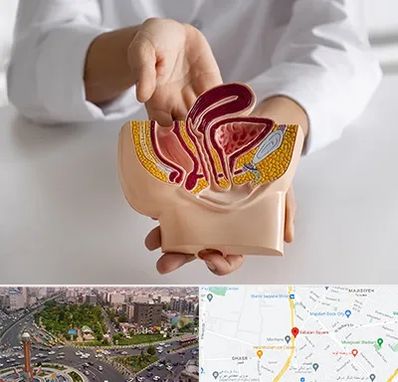 دکتر دستگاه تناسلی مردان در سبلان