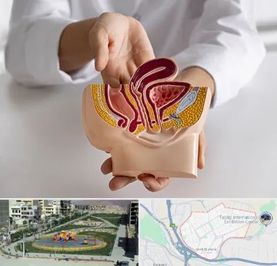 دکتر دستگاه تناسلی مردان در مرزداران تبریز