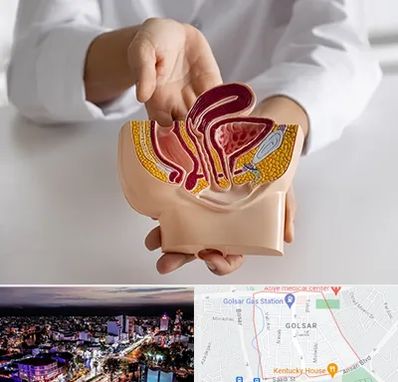 دکتر دستگاه تناسلی مردان در گلسار رشت 