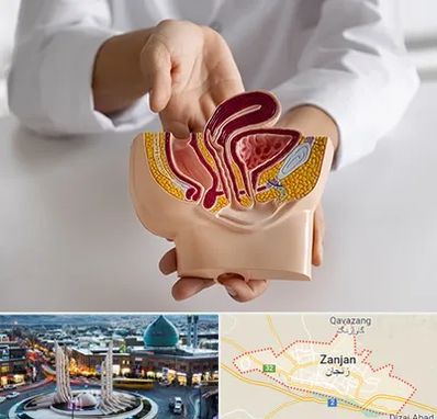 دکتر دستگاه تناسلی مردان در زنجان