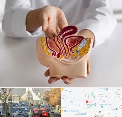 دکتر دستگاه تناسلی مردان در خیابان آزادی