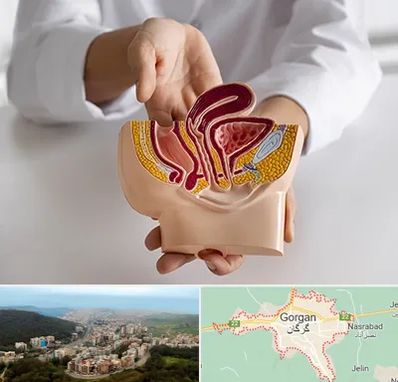 دکتر دستگاه تناسلی مردان در گرگان