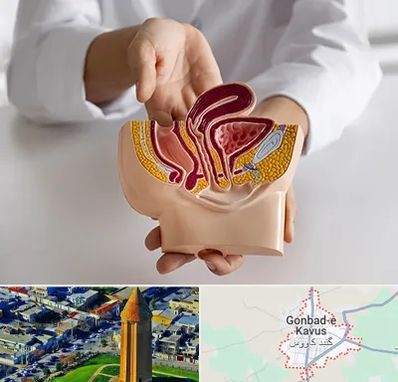 دکتر دستگاه تناسلی مردان در گنبد کاووس