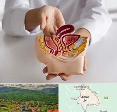 دکتر دستگاه تناسلی مردان در آمل