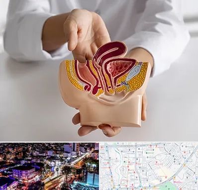 دکتر دستگاه تناسلی مردان در منظریه رشت 