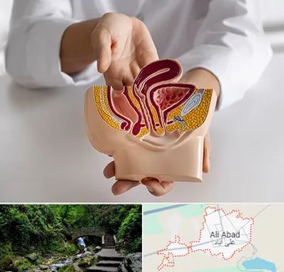دکتر دستگاه تناسلی مردان در علی آباد کتول