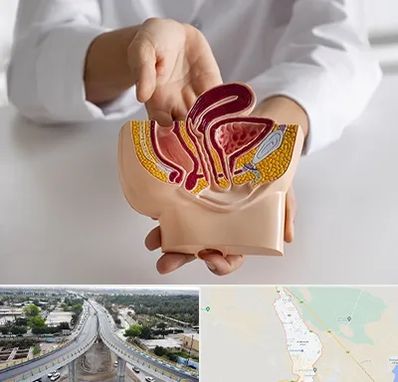 دکتر دستگاه تناسلی مردان در اندیمشک