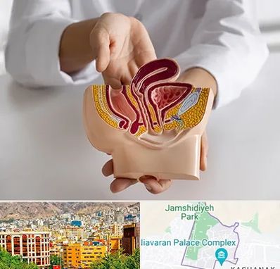 دکتر دستگاه تناسلی مردان در نیاوران