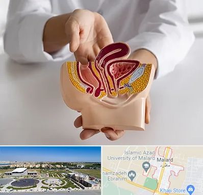 دکتر دستگاه تناسلی مردان در ملارد