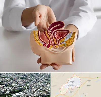 دکتر دستگاه تناسلی مردان در شاهرود