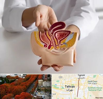 دکتر دستگاه تناسلی مردان در ولیعصر