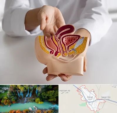 دکتر دستگاه تناسلی مردان در دورود