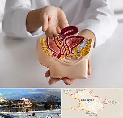 دکتر دستگاه تناسلی مردان در ملایر