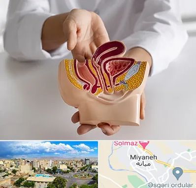 دکتر دستگاه تناسلی مردان در میانه