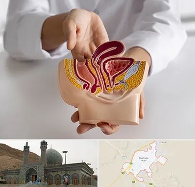 دکتر دستگاه تناسلی مردان در شهرضا