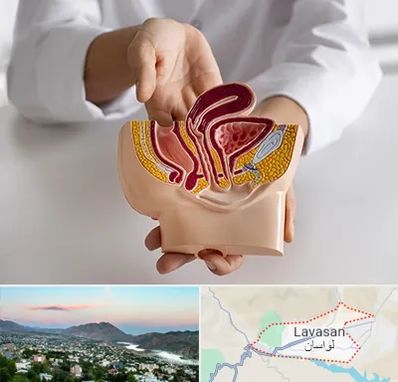 دکتر دستگاه تناسلی مردان در لواسان