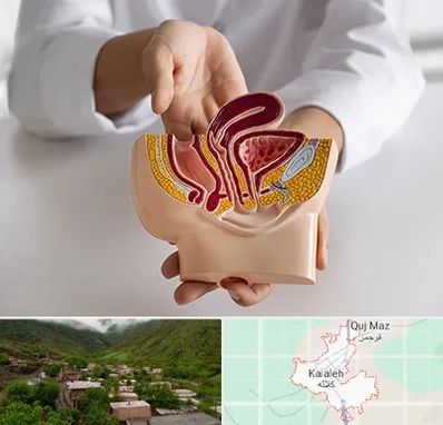 دکتر دستگاه تناسلی مردان در کلاله