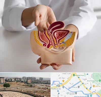 دکتر دستگاه تناسلی مردان در کوی وحدت شیراز 