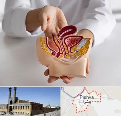دکتر دستگاه تناسلی مردان در پیشوا