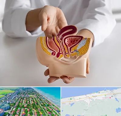 دکتر دستگاه تناسلی مردان در فریدونکنار